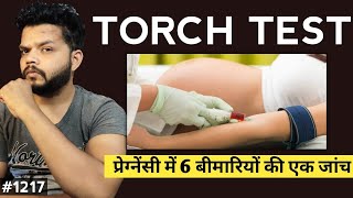 Torch Test Kya Hota Hai Kyon Or Kaise Kiya Jata Hai  Torch Test Explained In Hindi [upl. by Enitsahc]