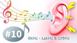 Music that goes away tinnitus when it suits your ears  10 Solfeggio Frequency 174Hz [upl. by Hewitt]