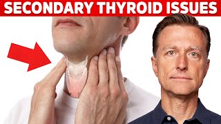 Most Thyroid Issues Are Secondary to Other Problems – Dr Berg [upl. by Gans]