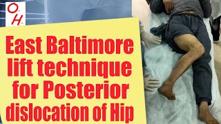 How to reduce a Hip dislocation or a dislocated Hip [upl. by Lawley]