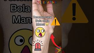 ¿UN TUMOR EN LA MANO ⚠️😱 shortvideo [upl. by Leugimesoj]