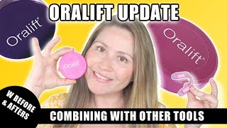 ORALIFT UPDATE W BEFORE amp AFTERS  COMBINING WITH OTHER TOOLS [upl. by Neelav]