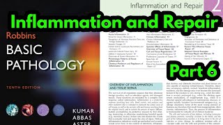 Arachidonic Acid metabolites Robbins pathologyProstaglandins and LeukotrienesInflammatory Mediator [upl. by Inoj]