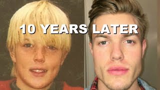 My Full 10 Year Jawline Transformation [upl. by Lietman]