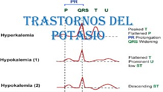 TRASTORNOS DEL POTASIO HIPOKALEMIA  HIPERKALEMIA  TRATAMIENTO Y MANEJO [upl. by Ellenohs761]