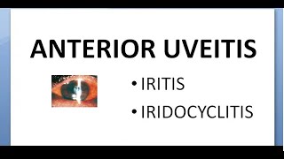 Ophthalmology 162 Anterior Uveitis Iritis IridoCyclitis Non suppurative glaucoma mechanism treatment [upl. by Chaille]