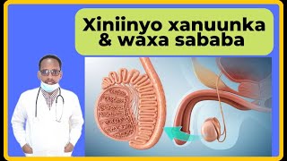 XINIINYO XANUUNKA TESTICULAR PAIN WAXAYABAHA KEENA CALAMADAHA LAGU GARTOamp DAWEYN DR MAHAMAED LIBAAN [upl. by Ila]