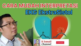 Cara Mudah Interpretasi EKG EkstraSistol dari Atrial Junctional Supraventrikular dan Ventrikel [upl. by Etra]