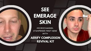 SEE EMERAGESKIN MICROCHANNEL STAMPERER FIRST HERE WITH AERIFY COMPLEXION REVIVAL KIT Dr Jason Emer [upl. by Corotto53]