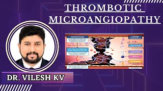 THROMBOTIC MICROANGIOPATHYTMA  DR VILESH K V [upl. by Attennyl]