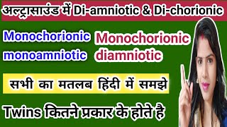 twins kitne prakar ke hote hai dichorionic diamniotic twins in hindi monochorionic diamniotic twins [upl. by Retsof]