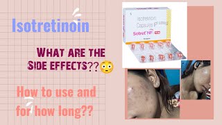 Side effects  Sotret Nf 16mg review acne isotretinoin clearskin clearskinjourney [upl. by Neehcas]