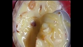 Easy sweet recipe Semiya custard 🍮 quick and simple recipe [upl. by Boothe391]