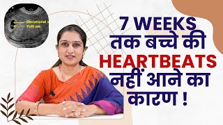 Why Heart Beat Never Comes In Early Pregnancy [upl. by Lekcim]