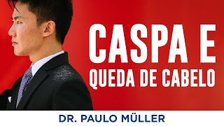 Caspa e Queda de Cabelo  Dr Paulo Müller Dermatologista [upl. by Neilla]