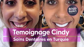 SOINS DENTAIRES  🦷 Témoignage de Cindy  20 facettes dentaires Emax  BODYEXPERT [upl. by Gnil]