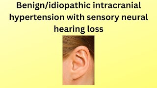 benign intracranial hypertension with hearing loss a rare case [upl. by Olympie]