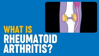 What is rheumatoid arthritis [upl. by Anatola]