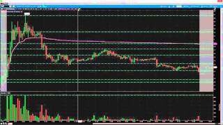 Madaz Mindset Ep 2  How I Recover Psychologically to Trade After Taking a Big Loss Earlier [upl. by Ashia]