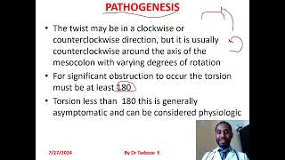 Volvulussigmoidcecaltransverse colonsplenic flexture part I by dr Tadesse fenta [upl. by Reilamag]