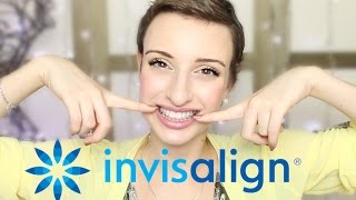 PARLONS PEU PARLONS DENTS  Les gouttières INVISALIGN ❁ [upl. by Lav]