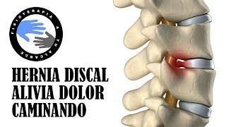 Hernia discal alivia el dolor mientras caminas [upl. by Leopoldeen]