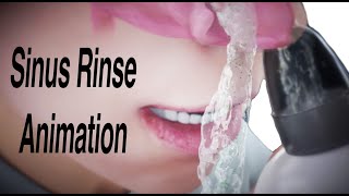 Sinus Rinse Animation [upl. by Sylvie190]