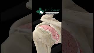 Shoulder arthroplasty animation  Total Shoulder Replacement [upl. by Llerral]