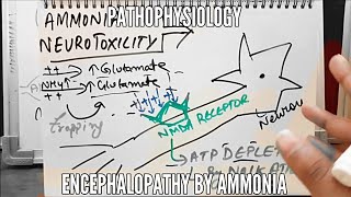 Ammonia Neurotoxicity  Encephalopathy  Pathophysiology [upl. by Aneel]