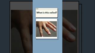 Skin Problems amp Diseases MustKnow English Terms dailyenglish quiz learnenglish [upl. by Ydde287]