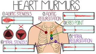 Learn Heart Murmurs In 10 Minutes With Heart Murmur Sounds [upl. by Sucramej]