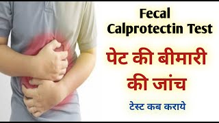 calprotectin stool test in hindi I fecal calprotectin test [upl. by Airtina890]