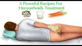 5 Powerful Recipes For Hemorrhoid Treatment [upl. by Lainey664]