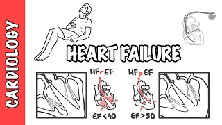 Heart failure with reduced and preserved ejection fraction pathophysiology and treatment [upl. by Ahsaei]