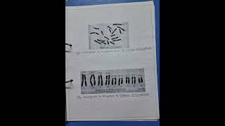 To prepare the Karyotype amp ideogram from given photograph of somatic metaphase chromosome [upl. by Marks235]