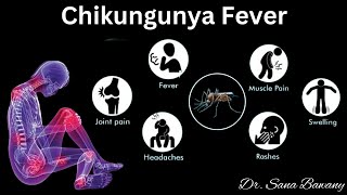 Chikungunya Fever Signs and SymptomsDiagnosis and Treatment [upl. by Dnomaid]