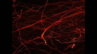 Reward Circuit and Nucleus Accumbens [upl. by Thalia]