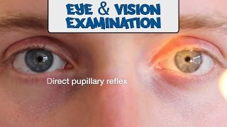 Examination of the Eyes and Vision  OSCE Guide old version  UKMLA  CPSA [upl. by Nelloc]