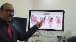 Preauricular sinus English Patient teaching programme [upl. by Leira]