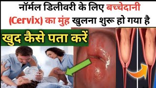 9वे महीने में बच्चेदानी का मुंह खुलने के लक्षण  SYMPTOMS OF CERVIX OPENINGCervix opening symptoms [upl. by Annaihr]