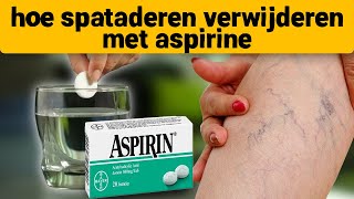 Spataderen verdwenen op de 7e dag neem aspirine en [upl. by Tsugua]