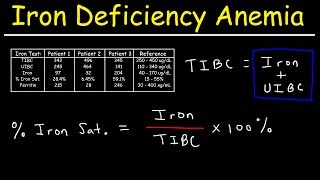 Iron Deficiency Anemia  TIBC UIBC Iron Saturation Transferrin amp Ferritin [upl. by Mayrim]