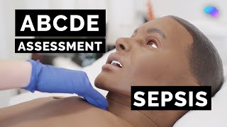 ABCDE Assessment  Sepsis  Emergency Simulation Scenario  OSCE Guide  UKMLA  CPSA [upl. by Luhar]