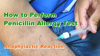 Penicillin G Allergy Test  Benzylpenicillin  Type 1 Hypersensitivity Reaction  How to Do [upl. by Etnahsa855]