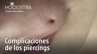 Complicaciones de los piercings  22192 [upl. by Aicilak]