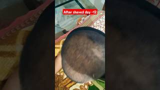 After hair shaving day 12 stop hair loss finasteride stophairfall ytshorts [upl. by Ramsden]