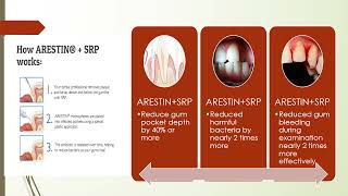 ArestinPeriodontal Therapy [upl. by Trescott]