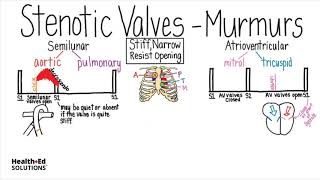 Heart Murmurs and Valve Disease Heart Murmur Series [upl. by Arnuad]