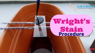 Wrights Stain Test  Wrights Staining [upl. by Fenton344]