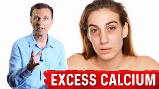 Serious Excess Calcium Side Effects SoftTissue Calcium – DrBerg [upl. by Perry666]